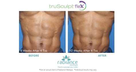 trusculpt flex avon